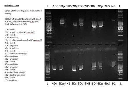 Gel electrophoresis: Visualising and interpreting the results.
